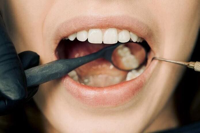 ¿Cómo debe tratar el dentista a un paciente con la boca seca?