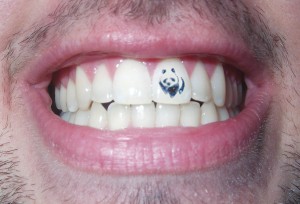 La moda de los tatuajes dentales llega de Asia y Estados Unidos.