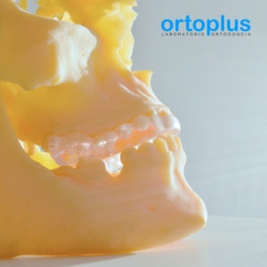 Ortoplus impresión 3D