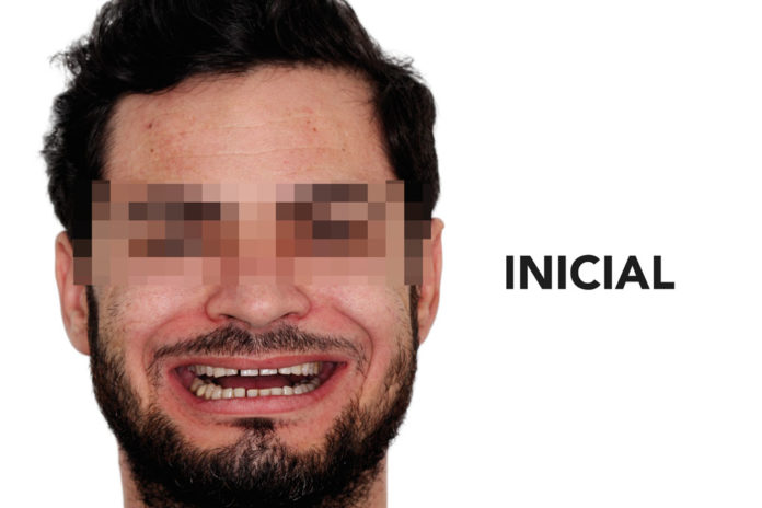 312_InformeDeDiego
