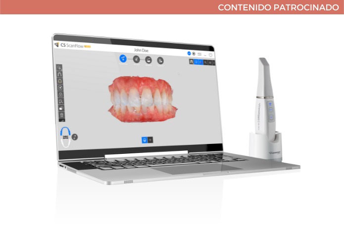 Carestream Dental presenta el CS 3800