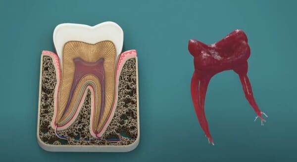 La pulpa dental en el interior de un diente.