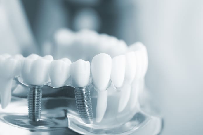 Investigadores de la Universidad de Extremadura estudian cómo incorporar elementos del esmalte natural del diente a las prótesis dentales