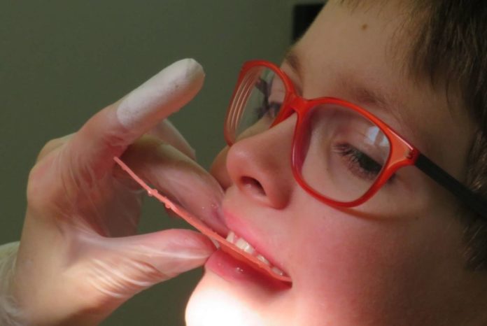 Niños autistas y visitas al dentista: un estudio sobre cómo lo perciben los padres y cómo mejorar la experiencia