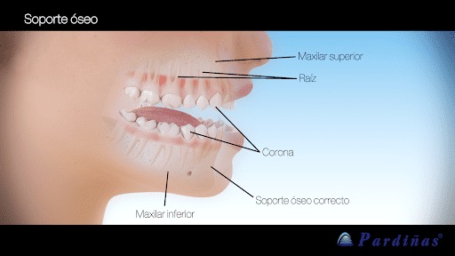 Imagen que muestra las partes del diente y cómo se integran en nuestra boca