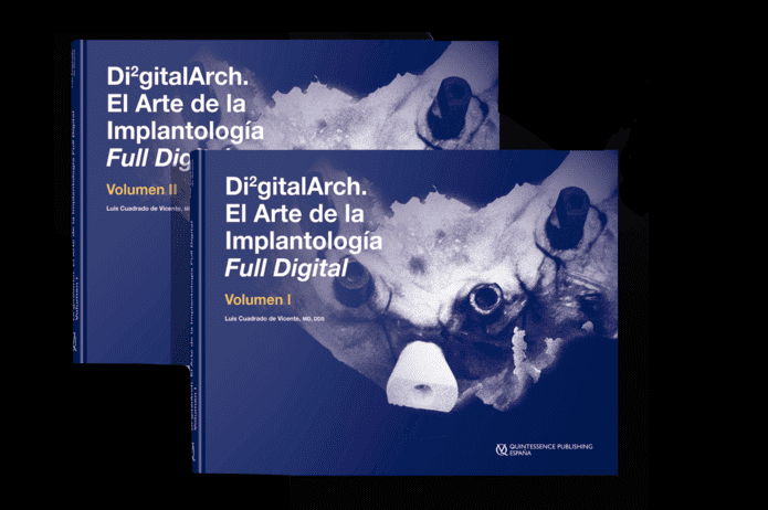 Protocolos Di²gitalArch®: La arcada completa full digital. Técnica Di²gitalArch®️ 2.0