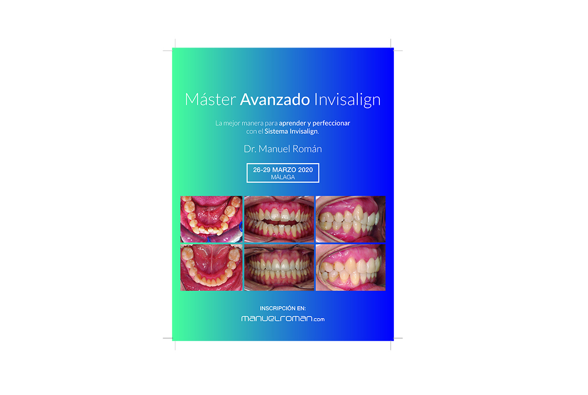 Cómo funciona Invisalign? ▷ Clínica Dental Maestro