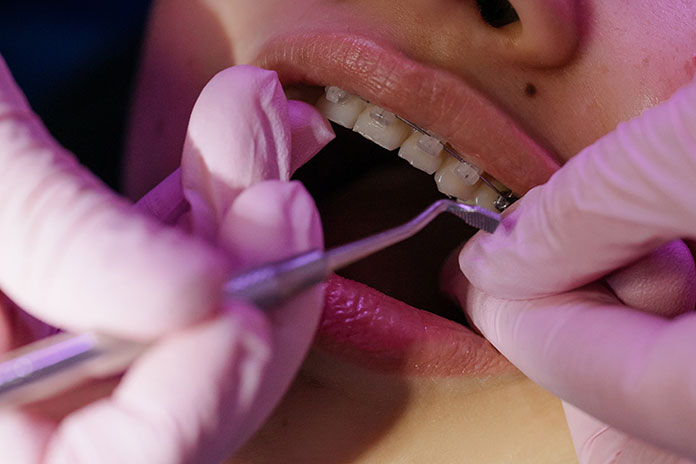 Beneficios de un tratamiento de ortodoncia