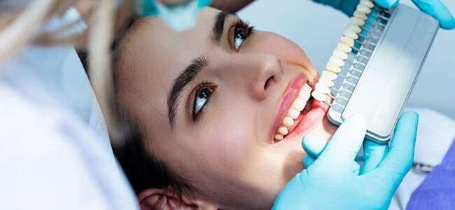 Cuatro razones por las que deberías evitar los tratamientos de blanqueamiento dental caseros