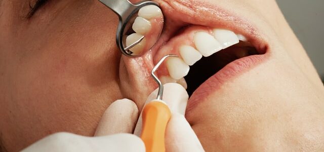 Las enfermedades periodontales y el cáncer gastrointestinal