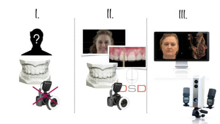 El escáner facial como herramienta para el diseño digital tridimensional de la sonrisa