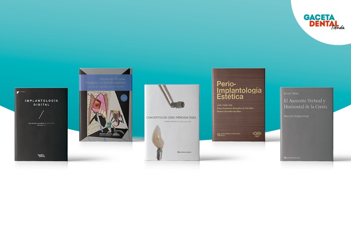 Los 5 libros más actuales e imprescindibles sobre Implantología