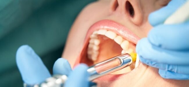 Se cree que el pequeño estudio es el primero en evaluar los efectos sedantes del remimazolam en cirugía oral ambulatoria en relación con el midazolam.