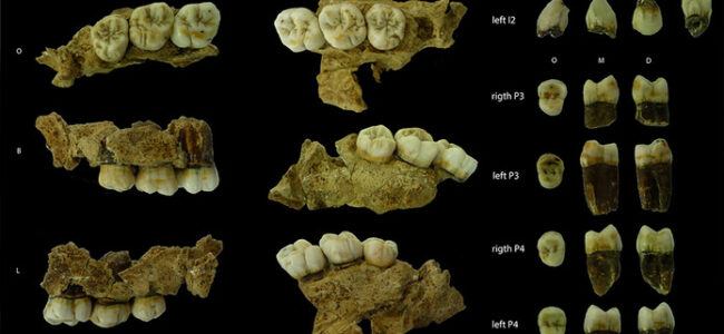 Restos dentales maxilares de Biache-Saint-Vaast (BSV)