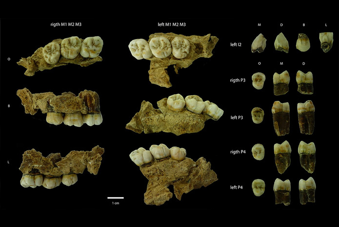 Restos dentales maxilares de Biache-Saint-Vaast (BSV)