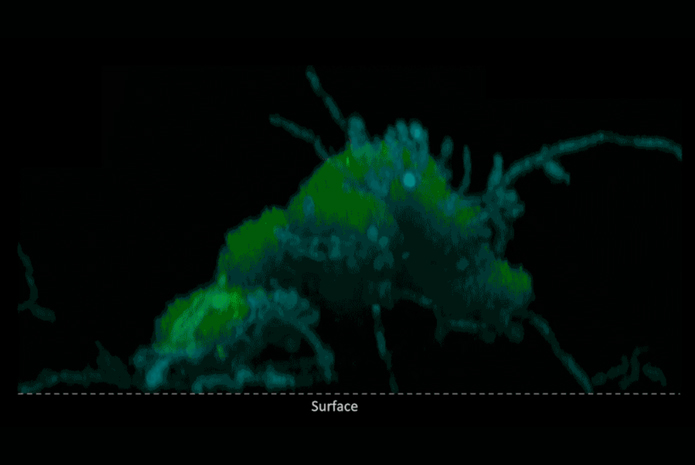 Los hongos Candida albicans (azul) y las bacterias Streptococcus mutans causantes de caries (verde) forman conjuntos que 