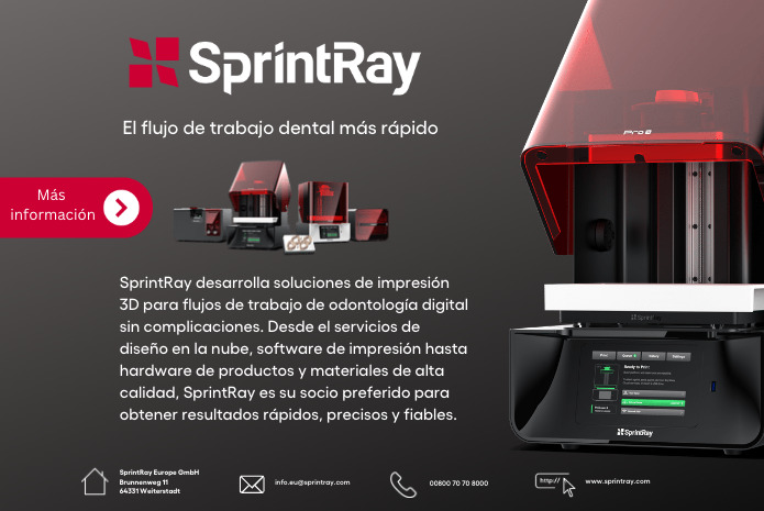 SprintRay, soluciones digitales completas en impresión 3D