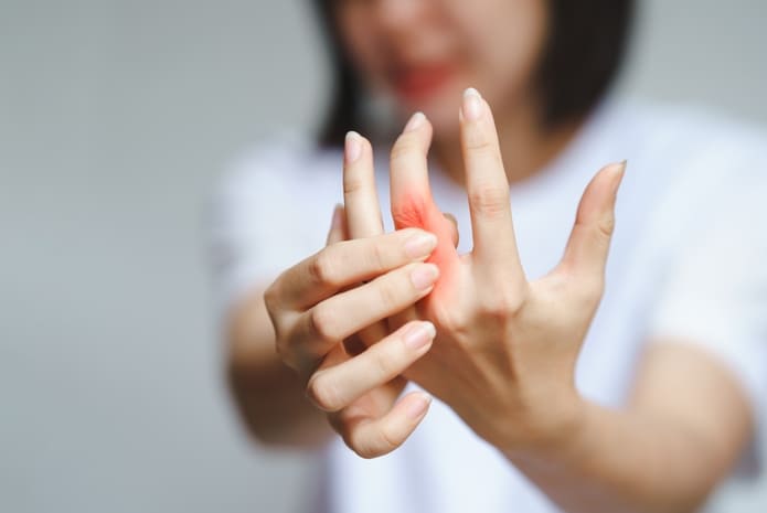 Las roturas de la mucosa oral desencadenan respuestas de anticuerpos contra bacterias citrulinadas y proteínas humanas en la artritis reumatoide.