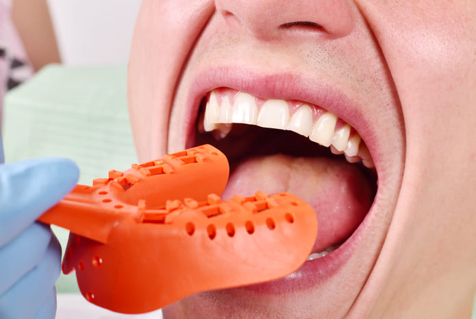 Un método poco convencional para evitar la arcada durante los tratamientos en el dentista