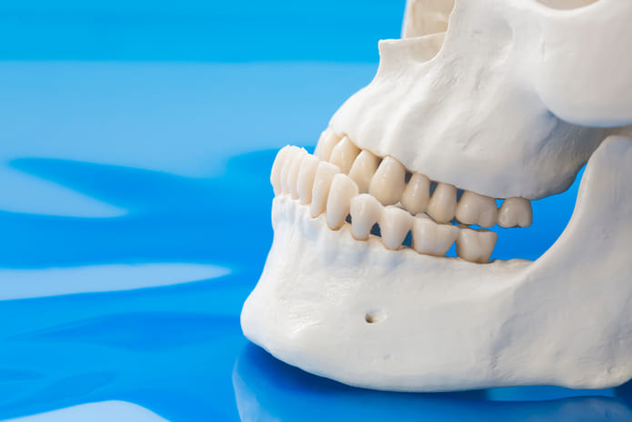 Procedimientos ortognáticos para el retroceso mandibular: la osteotomía de rama dividida sagital (SSRO) y la osteotomía de rama vertical intraoral (IVRO).