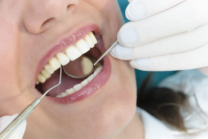 Uso de implantes dentales para reemplazar dientes perdidos.