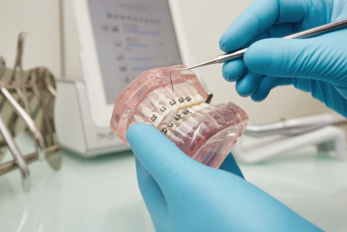 Austria reconoce la Ortodoncia como especialidad odontológica