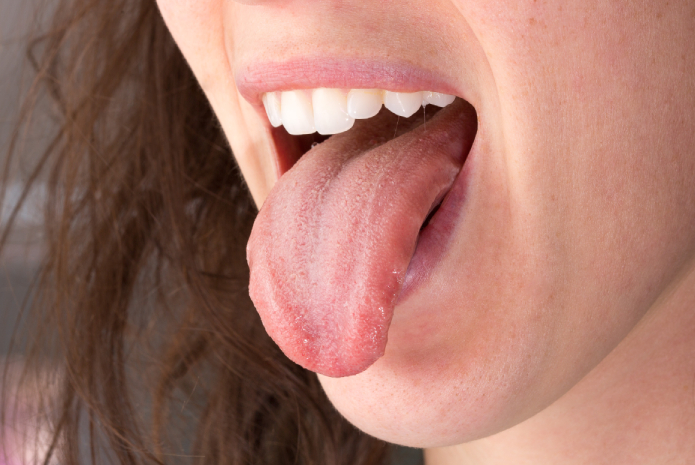 Enfermedades detectables en la lengua