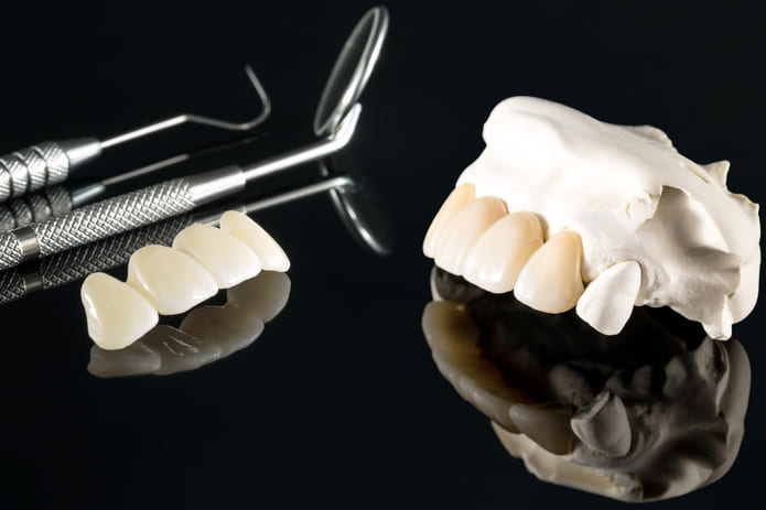 Análisis reciente sobre la tasa de supervivencia de diferentes restauraciones protésicas fijas y la influencia que ejerce la vitalidad dental sobre ellas.