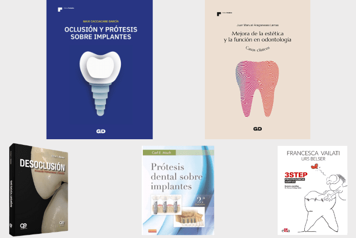 Las cinco publicaciones imprescindibles en el ámbito de la Prótesis Dental para mejorar tus conocimientos y habilidades.