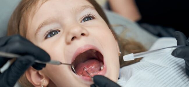 Investigación de la periodontitis apical crónica de los molares primarios en desarrollo de los sucesores permanentes en niños de 4 a 10 años.