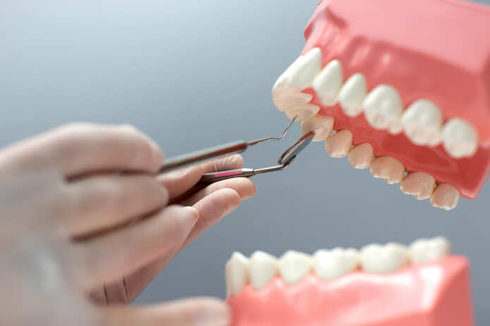 Efecto de diversos tratamientos en la unión de postes de fibra a la dentina radicular