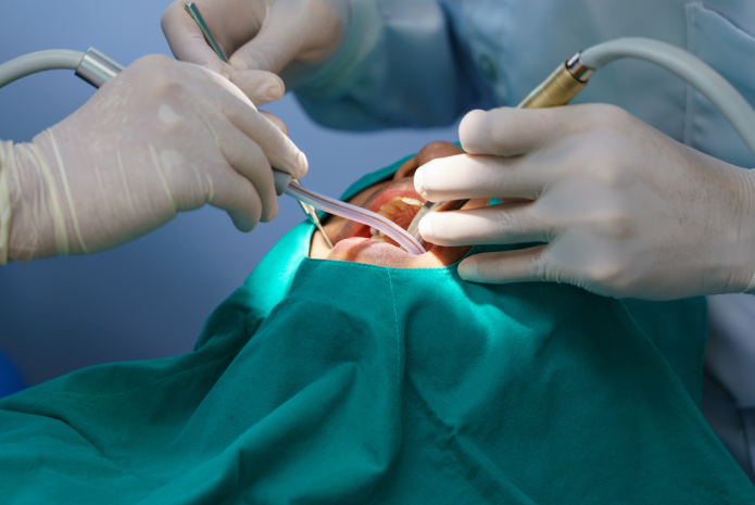Cirugía bucal en pacientes con trastornos de la coagulación