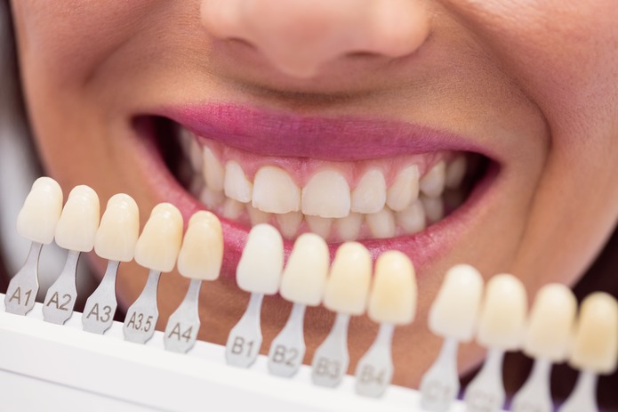 Un estudio evalúa la precisión y confiabilidad de diversos métodos digitales en la selección del color dental