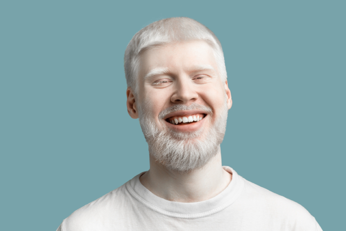 albinismo en la salud bucodental