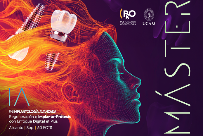 PgO UCAM