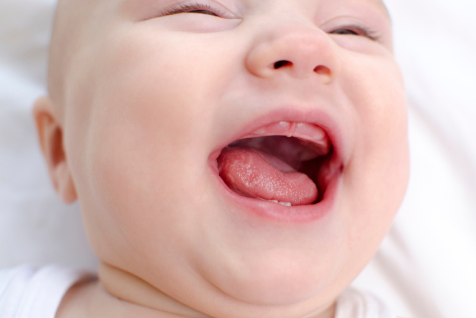 dientes neonatales