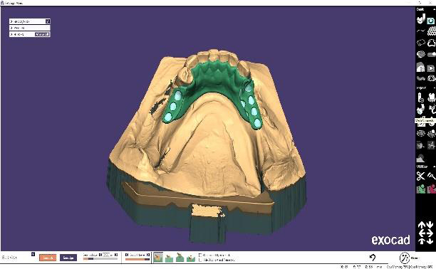 Prótesis, laboratorio.