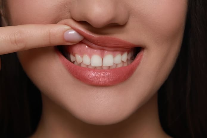 ¿Cuál es el color de unas encías sanas? ¿Cómo tengo que cuidarlas? Respondemos a estas preguntas.