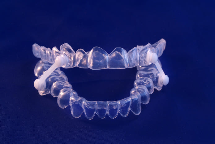 ¿Qué pacientes deben usar dispositivos orales para la apnea obstructiva del sueño?