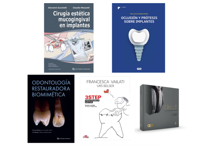 implantología y estética