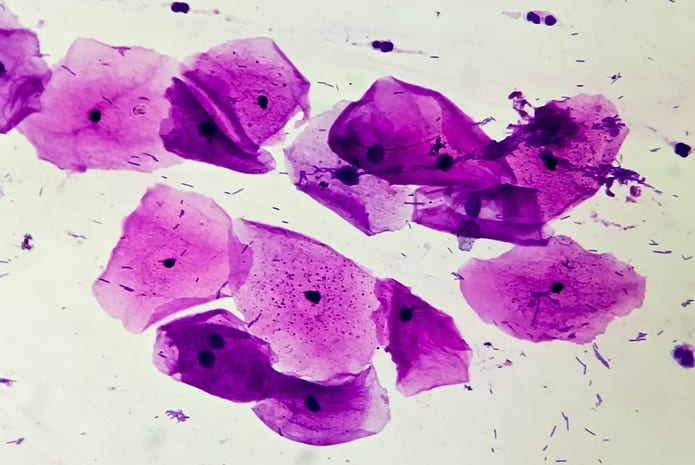 Descamación bucal que muestra células escamosas descamadas de la mucosa oral.
