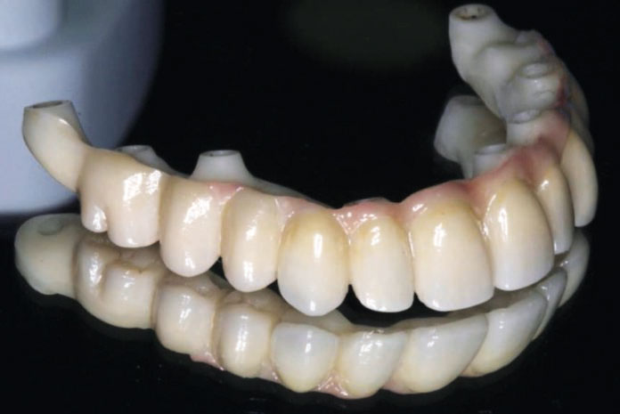 Prótesis atornilladas de circonio monolítico por CAD/CAM en Implantología