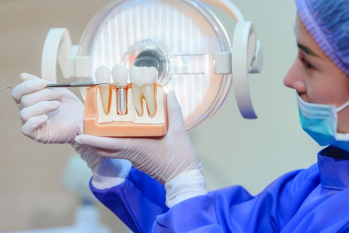 Un caso clínico que muestra las técnicas de implantes inmediatos.