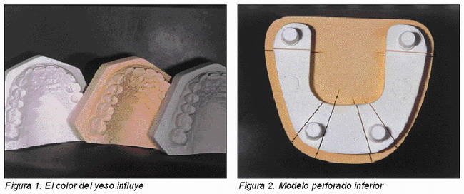 Modelo maestro - Gaceta Dental